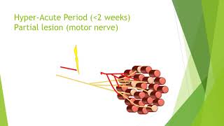 Nerve damage and repair [upl. by Rebmat]