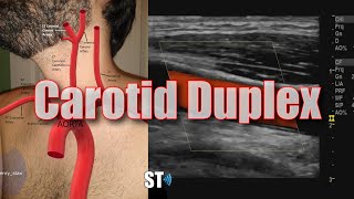 Carotid Duplex Exam [upl. by Roinuj]