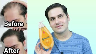 I tried Baby Shampoo for a year [upl. by Ressler257]