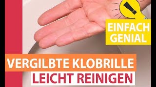 Vergilbte Klobrille leicht reinigen Toilettensitz von gelb nach weiß [upl. by Halueb]