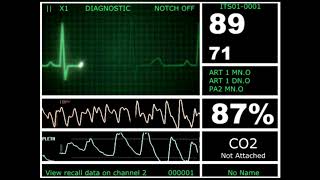 Hospital Monitor with FlatLine L HD [upl. by Peters]