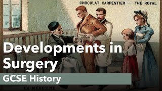 Developments in Surgery  GCSE History [upl. by Delaryd]