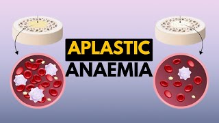 Aplastic Anaemia Causes Signs and Symptoms Diagnosis and Treatment [upl. by Mag]