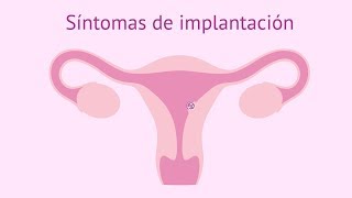 Síntomas de implantación del embrión [upl. by Chapa861]