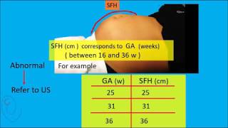 Symphysis Fundal Height  SFH  measurement [upl. by Starlene]