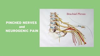 Pinched Nerves and Neurogenic Pain [upl. by Milks554]