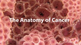 What Is Cancer What Causes Cancer amp How Is It Treated [upl. by Gamber]