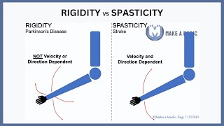 Rigidity vs Spasticity Explained [upl. by Nneb389]