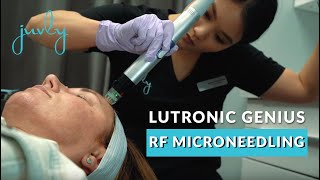 Lutronic Genius RF Microneedling  Juvly Aesthetics [upl. by Aileda]