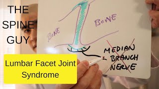 Lumbar Facet Joint Syndrome [upl. by Esaele]