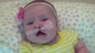 Cleft Lip and Palate Meet the Len Family 7 of 7 [upl. by Sheepshanks]