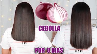 RETO3 CEBOLLA PARA HACER CRECER EL CABELLO Y DETENER LA CAIDA EN 8 DIAS 🧅 [upl. by Phelps980]