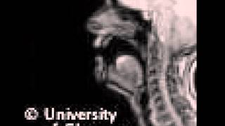 MRI voiceless bilabialvelar plosive [upl. by Bilek]