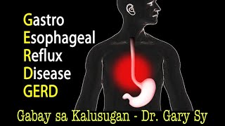 GastroEsophageal Reflux Disease GERD  Dr Gary Sy [upl. by Iohk]