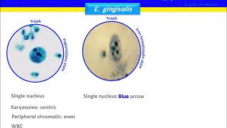 Entamoeba gingivalis [upl. by Nahsed]