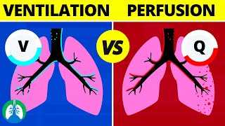 VentilationPerfusion VQ Ratio  Quick Medical Overview [upl. by Brod]