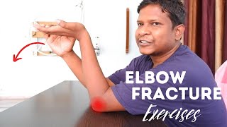 7 Elbow fracture exercise for Quick Improvement [upl. by Dominic]