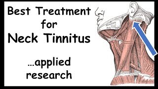 Best Treatment for NeckTinnitus  Somatictype [upl. by Petrina296]