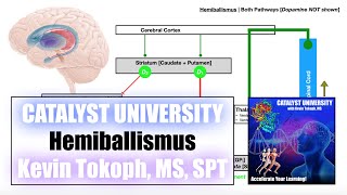 Hemiballismus  Pathogenesis SignsSymptoms and Detailed Mechanism [upl. by Sorvats808]