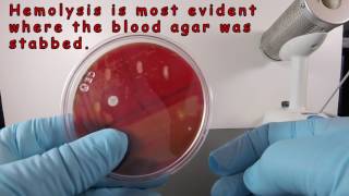 Beta Hemolysis on Blood Agar [upl. by Brawley]