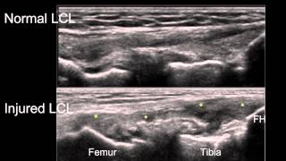 Anatomy of the Knee Joint [upl. by Metabel]