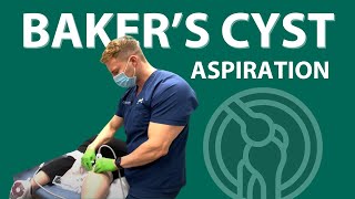 Bakers Cyst Treatment [upl. by Neelia]