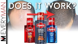 DOES CAFFEINE SHAMPOO WORK  Alpecin REVIEW amp Hair Growth Alternatives [upl. by Eelnodnarb]