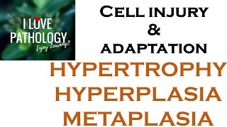 Cell Adaptations pathologyHYPERTROPHY HYPERPLASIA AND METAPLASIA [upl. by Nahtam]