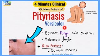 Pityriasis Versicolor Explained Like Water  Symptoms Pathogenesis Treatment  4 Minutes Clinical [upl. by Wiencke]