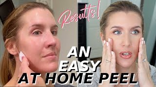 At Home Glycolic Acid Peel THAT WORKS  Over 40 Skincare [upl. by Esekram291]