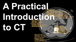 A Practical Introduction to CT [upl. by Annahsal]