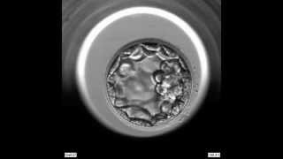 EmbryoScope Embryo Development  Blastocyst [upl. by Eanrahc]