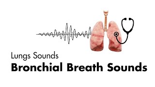 Bronchial Breath Sounds  EMTprepcom [upl. by Sivi]