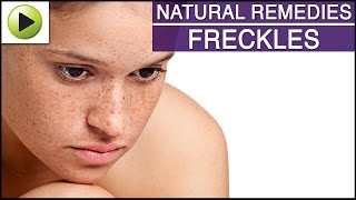 Skin Care  Freckles  Natural Ayurvedic Home Remedies [upl. by Notgnillew]