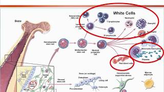 Aplastic Anemia Approach on Diagnosis and Treatment Options 2018 [upl. by Rotsen]