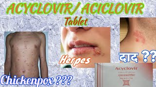 Acyclovir tablets  Herpikind  Herpikind Tablet  Zovirax  Zovirax tablets  uses side effects [upl. by Eirrol]