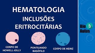 Inclusões nos Eritrócitos  Hematologia [upl. by Eng]