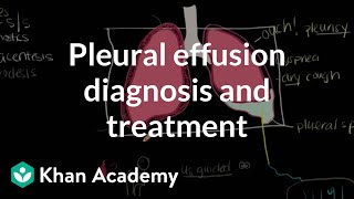 Pleural effusion diagnosis and treatment  Respiratory system diseases  NCLEXRN  Khan Academy [upl. by Lief]