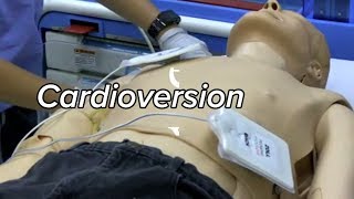 Cardioversion  Defibrillation Technique [upl. by Wagstaff]