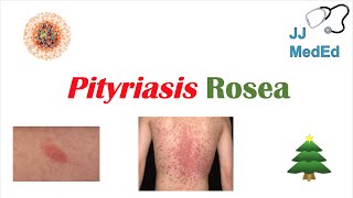 Introduction to Pityriasis Rosea  Possible Causes Symptoms and Treatment [upl. by Dahsar735]