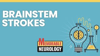 Brainstem Stroke Mnemonics Memorable Neurology Lecture 15 [upl. by Avir]