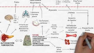 Fisiopatología de la pancreatitis aguda en 6 minutos [upl. by Rendrag]