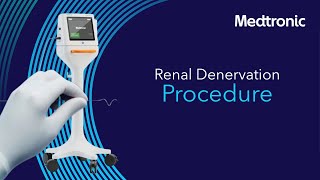 Radiofrequency Renal Denervation Procedure [upl. by Harlene119]