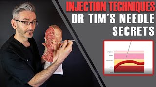 Injection Techniques Best Angles Depths How To Aspirate amp Stabilise Aesthetics Mastery Show [upl. by Pals]