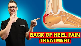 Retrocalcaneal Heel BURSITIS Treatment Heel Pain Exercises amp Massage [upl. by Sherl]