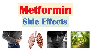 Metformin Side Effects amp Consequences [upl. by Eceela1]