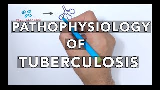 Pathophysiology of Tuberculosis [upl. by Mohr432]