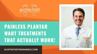 Painless Plantar Wart Treatments That Actually Work [upl. by Dranek]