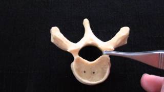 Typical Vertebra  Spinal column  Anatomy [upl. by Assirrem]