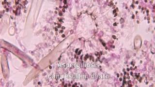 Aspergillus and Aspergillosis [upl. by Annayt]